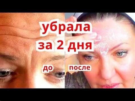 КОСМЕТОЛОГ | Морщины, Морщины на лбу, Маска