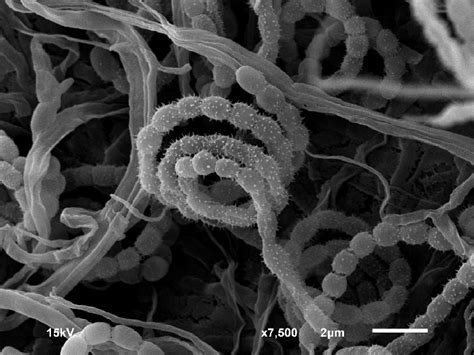 Scanning Electron Micrograph Showing The Spore Chain Of Strain Sr3 134