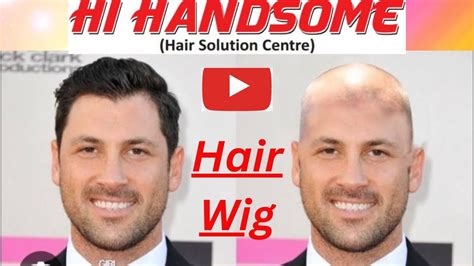 Hair Wig Process Hair Wig For Men Non Surgical Hair Transplant In