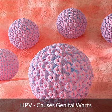 Genital Warts In Women Symptoms Causes And Treatment Dr Deepa Ganesh