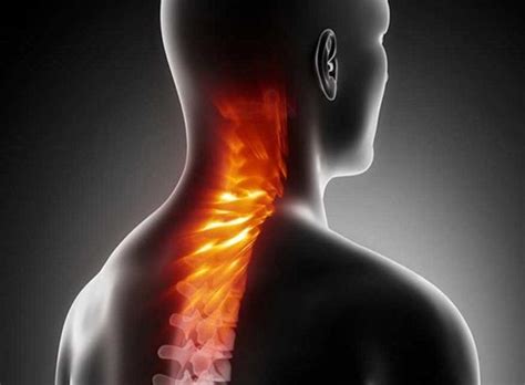 how long for ruptured disc to heal