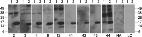 Immunoblot Showing Ige Reactivity Of 9 Patient Sera To A Commercially