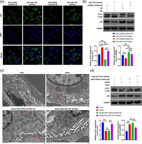 Effects Of Mir Inhibitor On Autophagy Level In Podocyte High