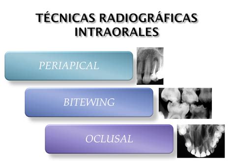 Radiología oral y maxilofacial Técnicas radiográfiacas intraorales