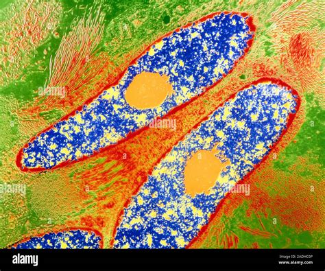 False Colour Transmission Electron Micrograph TEM Showing The Classic