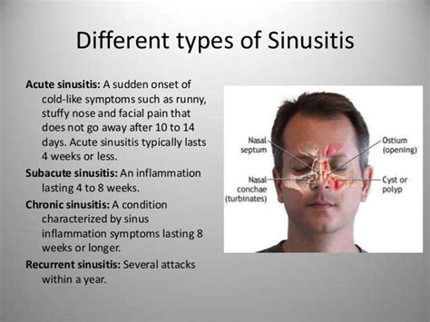 facial fungal infection - pictures, photos