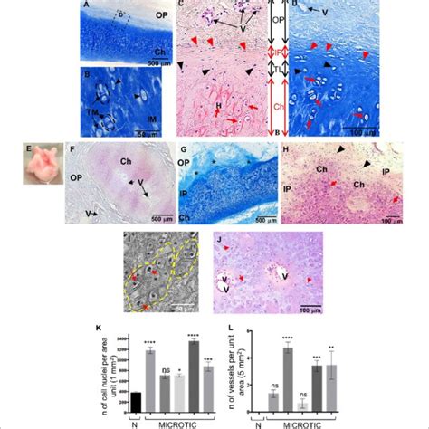 Histology Protein Expression And Nodule Formation In Microtic