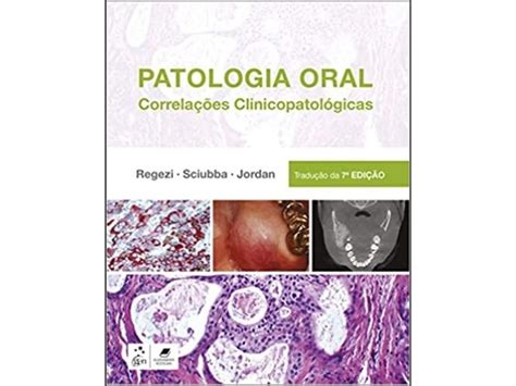 Patologia Oral Correla Es Clinicopatol Gicas Worten Pt