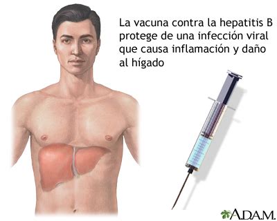 Hepatitis B MedlinePlus enciclopedia médica