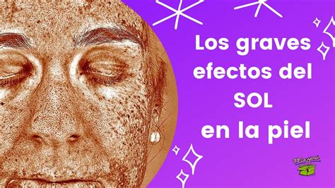 La Verdad Sobre Los Efectos Del Sol En Tu Piel Youtube