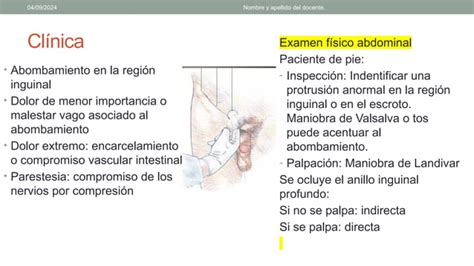 Hernias De La Pared Abdominal Manejo Pptx