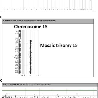 A B And C Array Comparative Genomic Hybridization ACGH Analysis