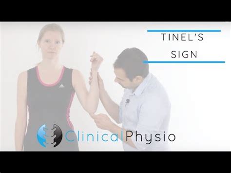 6 Proven Ulnar Nerve Exercises For Cubital Tunnel Syndrome