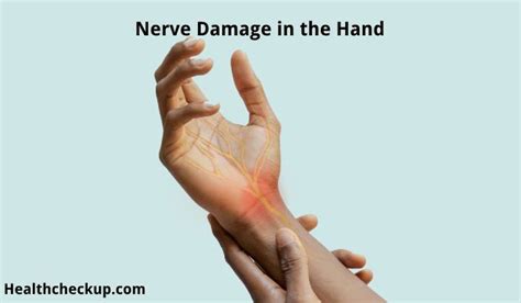 Nerve Damage in the Hand: Symptoms, Causes, and Treatment