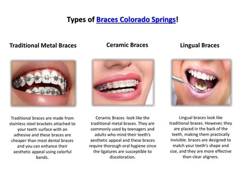 PPT Orthodontist In Colorado Springs PowerPoint Presentation Free