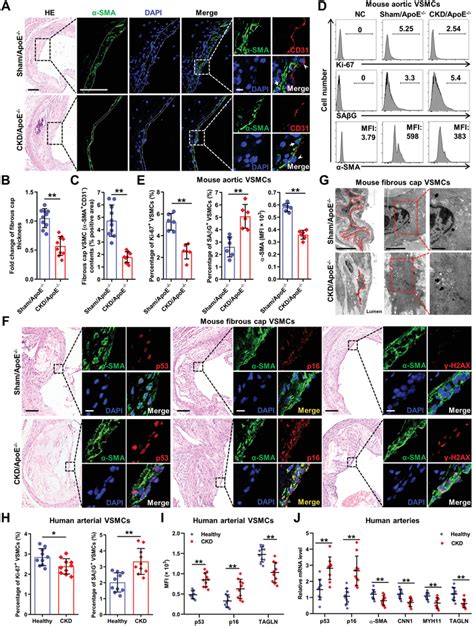 Vsmc Premature Senescence And Phenotypic Switching Contribute To Plaque