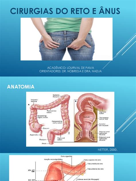 Cirurgia Reto E Anus Pdf Hemorróida Doenças Digestivas