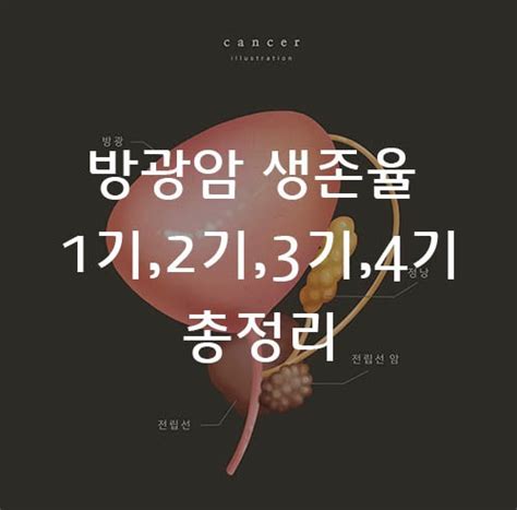 방광암 생존율 1기2기3기4기병기구분 네이버 블로그