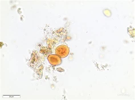 Parasitología Controllab