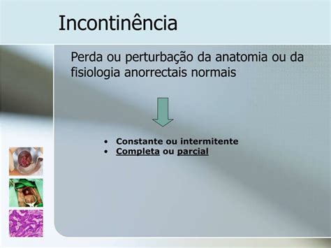 Ppt Patologia Perianal Powerpoint Presentation Free Download Id 829116