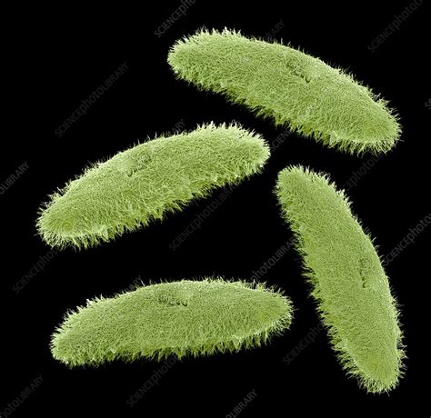 Ciliate protozoa, SEM - Stock Image - C048/1431 - Science Photo Library