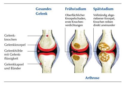 Lernkartei Anatomie Und Funktion Des Bewegungsapparat Lms Memocard