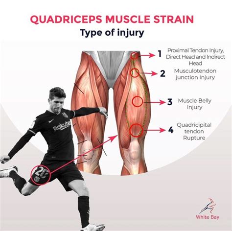 Quad Leg Muscles Anatomy Labeled Diagram, Vector