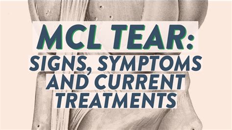 Mcl Tear Signs Symptoms And Current Treatments Youtube