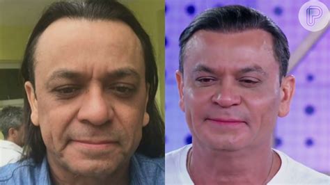 Um novo homem Frank Aguiar passa por harmonização facial e corta os