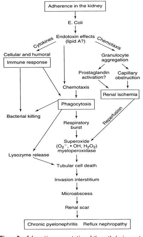 Figure From Reflux Nephropathy Semantic Scholar