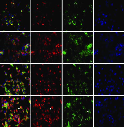 Co localization of AR and FKBP52 in L ns and L À ID4 cell lines