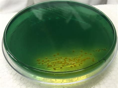 Cholera Colonies On Agar 2 Image Eurekalert Science News Releases