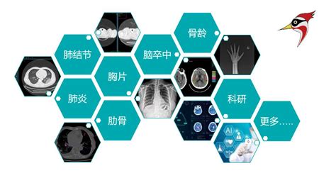 Ai影像辅助云诊断解决方案 人机“融合”，帮助医生快速定位病灶区域和分析病情，提供包括关键特征的智能量化报告，辅助快速诊断和精准治疗。 解决方案 杭州健培科技有限公司