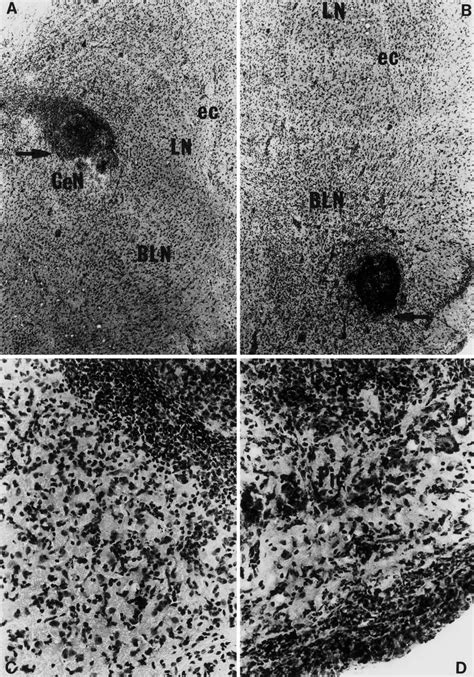 A Medium Power Photomicrograph Depicting Representative Infusion Site Download Scientific