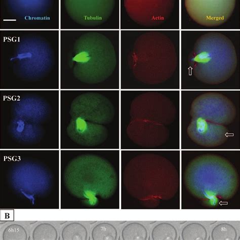 A Confocal Laser Micrographs Showing Cleavage Furrows And Segregation