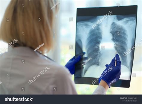 99 Damage Lung Xray Images, Stock Photos & Vectors | Shutterstock