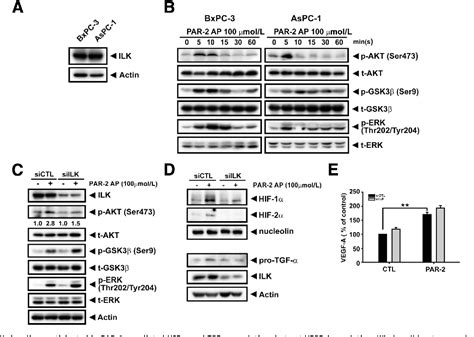 Figure 4 From Tumorigenesis And Neoplastic Progression Activated Par 2