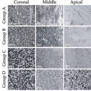 Representative Scanning Electron Micrographs Of The Three Canal Thirds