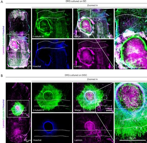 Effects Of Isc And Disc On Drg Neurite Outgrowth A Download