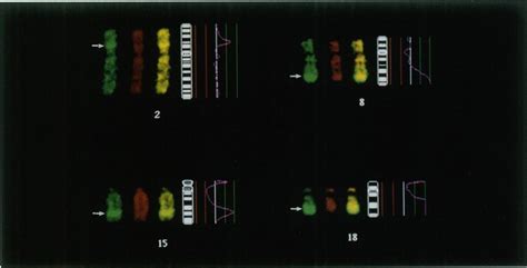 Partial CGH Karyotype Of Case AMP12 Images Were Acquired And Evaluated