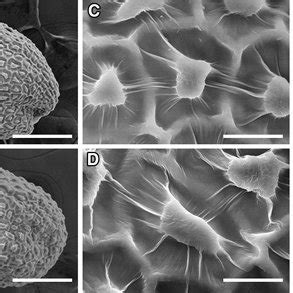 Scanning Electron Micrographs Of Wild Type And Mur A C And E The