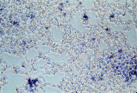 yeast cells saccharomyces cerevisiae stock image