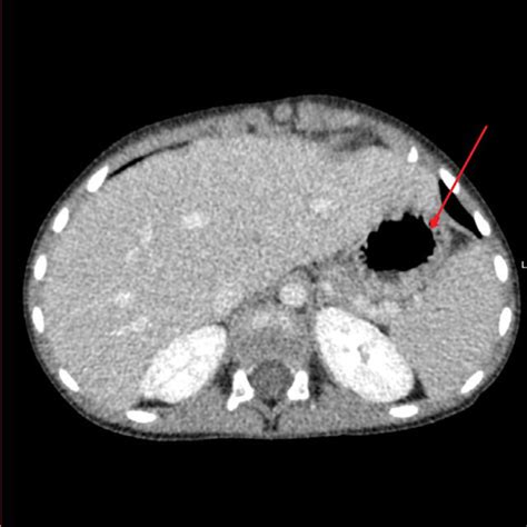 The Image Is Showing Multi Slice Computed Tomography MSCT Of The