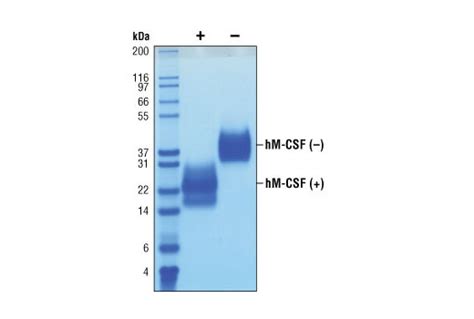 Human CSF 1 M CSF Recombinant Protein Cell Signaling Technology