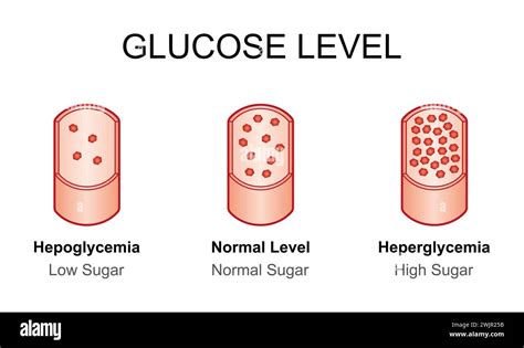 Blood glucose levels, illustration Stock Photo - Alamy