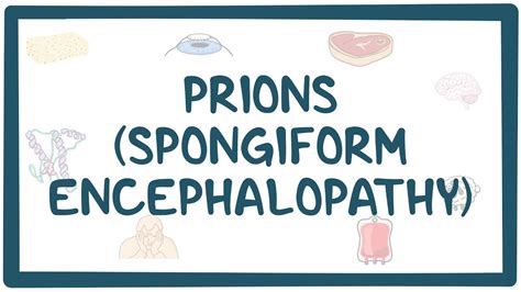 Prions (Spongiform encephalopathy): Video & Anatomy | Osmosis