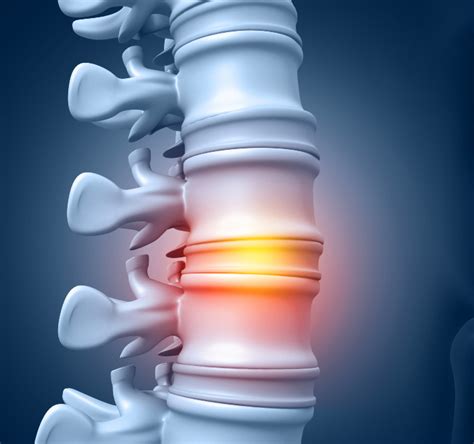 Orthopedic Laser Spine Surgery