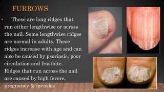 Nail diseases and disorders | PPT