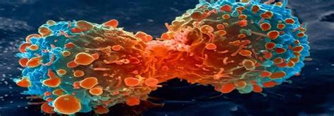 Quando O Cancer Foi Descoberto - A cura do câncer já foi descoberta?