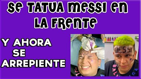 Se Arrepiente De Haberse Tatuado Messi En La Frente Y Confiesa Vivir